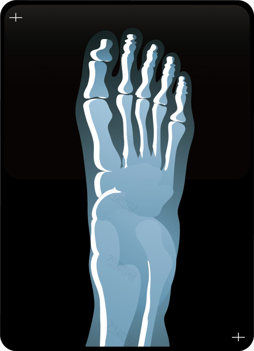 x光片png矢量素材